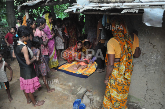 Baby Runa Begum (Roona Begum), Hydrocephalus patient 