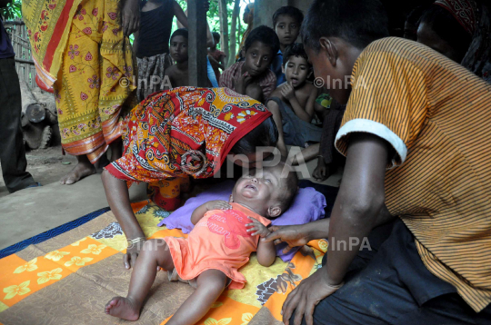 Baby Runa Begum (Roona Begum), Hydrocephalus patient 