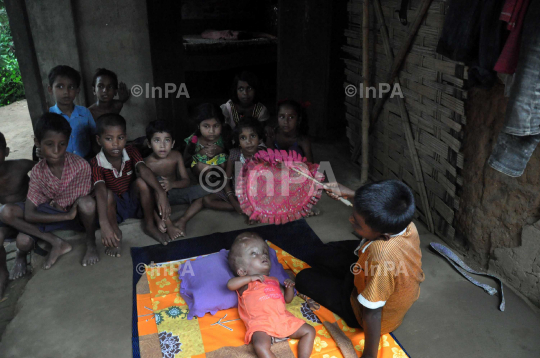 Baby Runa Begum (Roona Begum), Hydrocephalus patient 