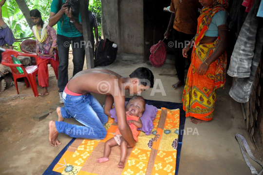 Baby Runa Begum (Roona Begum), Hydrocephalus patient