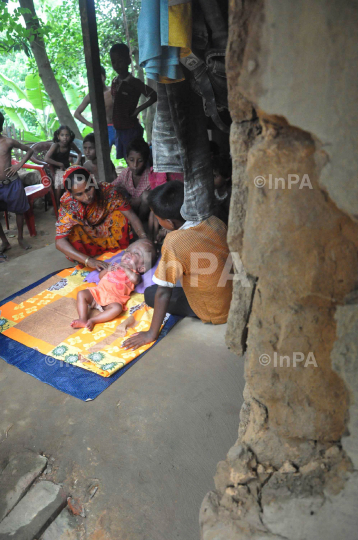 Baby Runa Begum (Roona Begum), Hydrocephalus patient