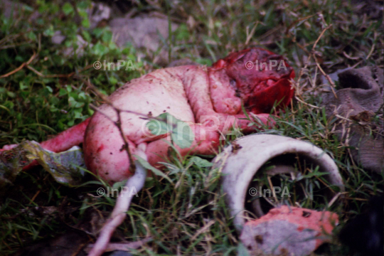 Premature baby thrown into garbage