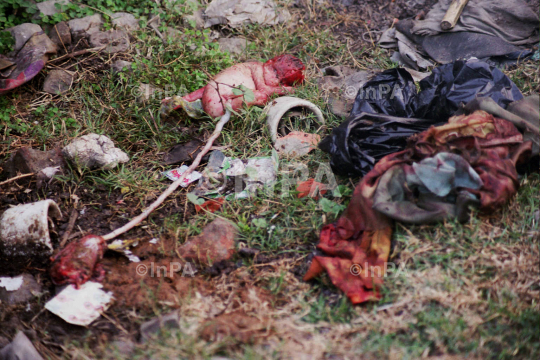 Premature baby thrown into garbage